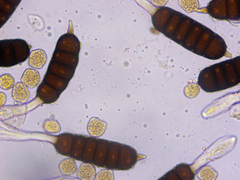 Phragmidium bulbosum