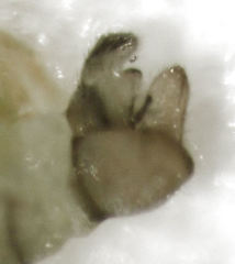 Acizzia acaciaebaileyanae