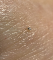 Dermanyssus gallinae