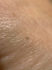 Dermanyssus gallinae