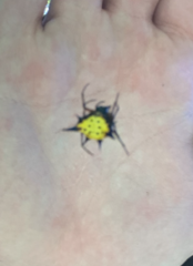 Macracantha hasselti