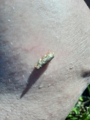 Choristoneura houstonana