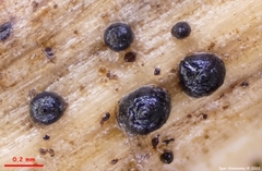 Leptosphaeria doliolum