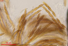 Leptosphaeria doliolum