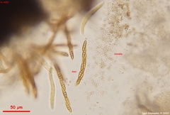 Leptosphaeria doliolum