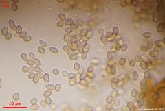 Leptosphaeria doliolum