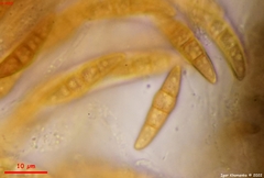 Leptosphaeria doliolum