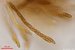 Leptosphaeria doliolum