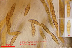 Leptosphaeria doliolum