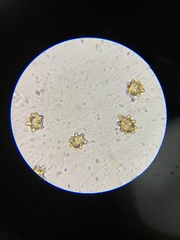 Inocybe margaritispora