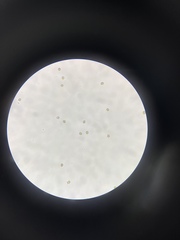 Inocybe margaritispora