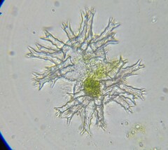 Staurastrum arctiscon