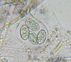 Glaucocystis