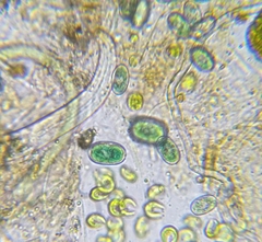 Glaucocystis