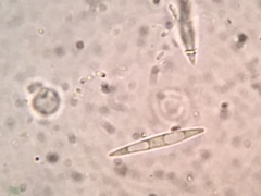 Lachnellula ellisiana