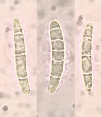 Strossmayeria basitricha