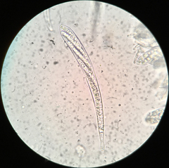 Strossmayeria basitricha