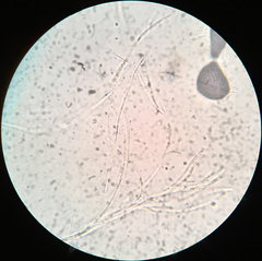 Strossmayeria basitricha