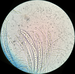 Strossmayeria basitricha