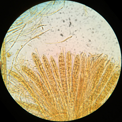 Strossmayeria basitricha