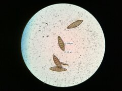 Strossmayeria basitricha