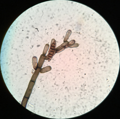 Strossmayeria basitricha