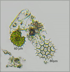 Pseudopediastrum boryanum