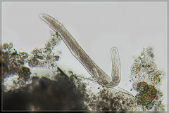 Spirostomum teres
