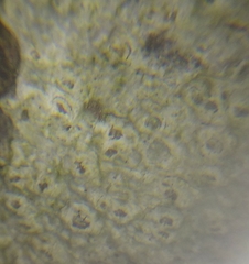 Pertusaria leioplaca