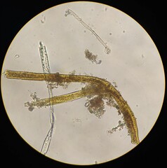 Aeolosoma hemprichi