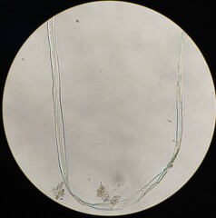 Gonatozygon monotaenium