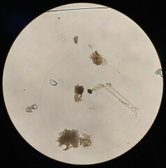 Achlya racemosa