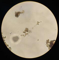 Gonatozygon monotaenium