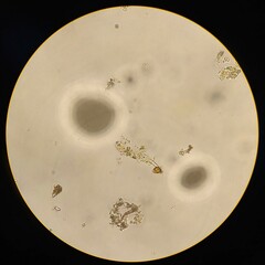 Gonatozygon monotaenium