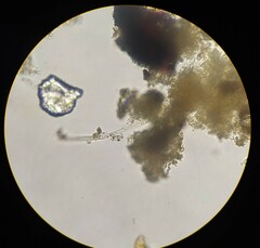 Gonatozygon monotaenium