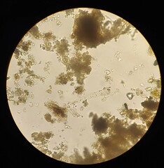 Gonatozygon monotaenium