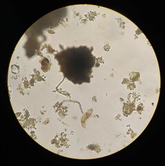 Gonatozygon monotaenium