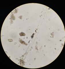 Achlya racemosa