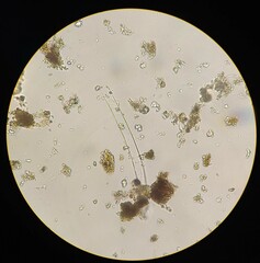 Achlya racemosa