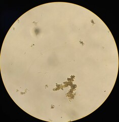 Taphrinomycetes