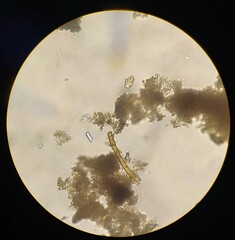 Planktothrix rubescens