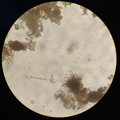 Gonatozygon monotaenium