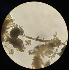 Achlya racemosa