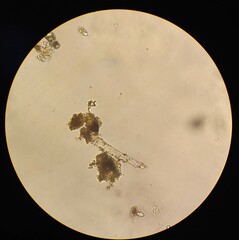 Achlya racemosa