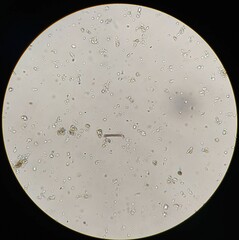Planktothrix rubescens