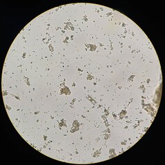 Pinnulariaceae