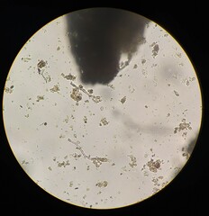 Planktothrix rubescens