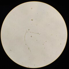 Pseudanabaena