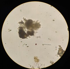 Planktothrix rubescens