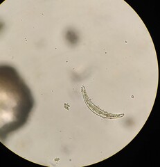 Closterium moniliferum